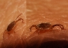 Erythraeidae Erythraeidae
