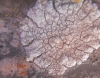 Pertusaria pertusa (Weigel) Tuck.